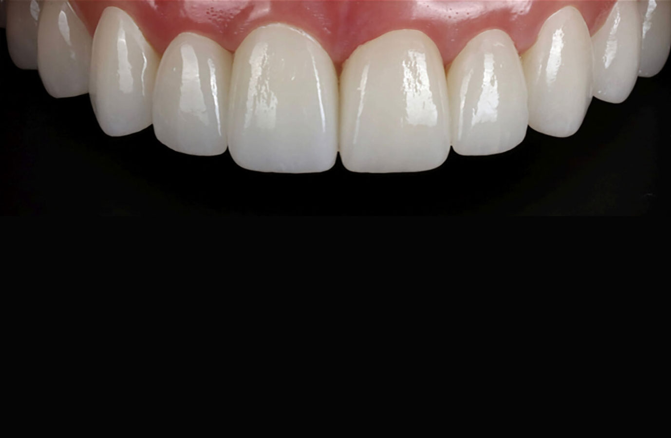 ZirNEER - featured image